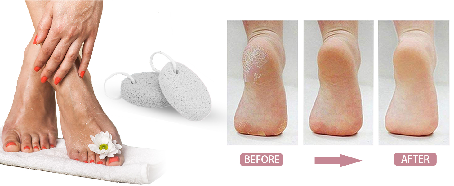 MAYKI Pumice Stone for Feet