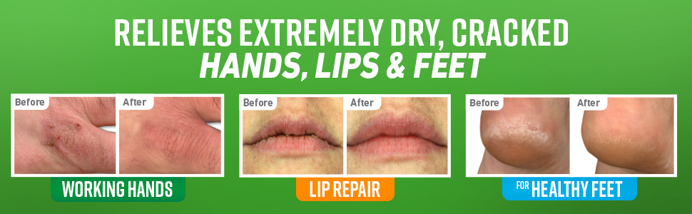 when the hands that do the fixing need fixing