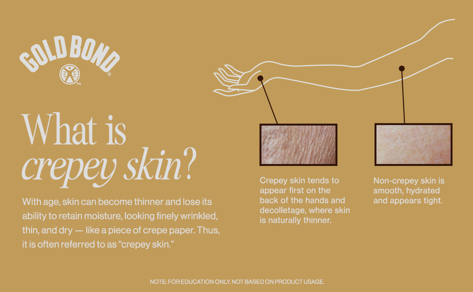 What is crepey skin