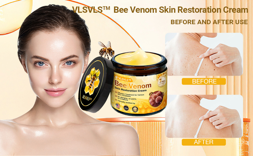 チュルミ　SkinVenus Premium repair Cream Amazon.com: VLSVLS Bee Venom Skin Restoration Cream