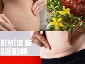 huile millepertuis visage huile millepertuis bienfaits peau utilisation huile arnica millepertuis