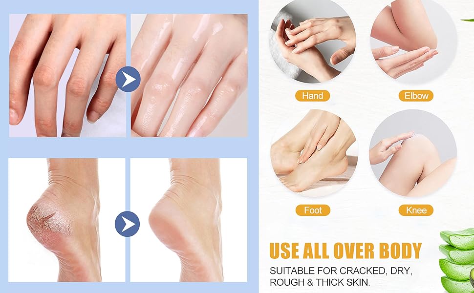 Moisturising and Relieves Cracking and Dryness Foot Cream for Dry Cracked Feet And Hands