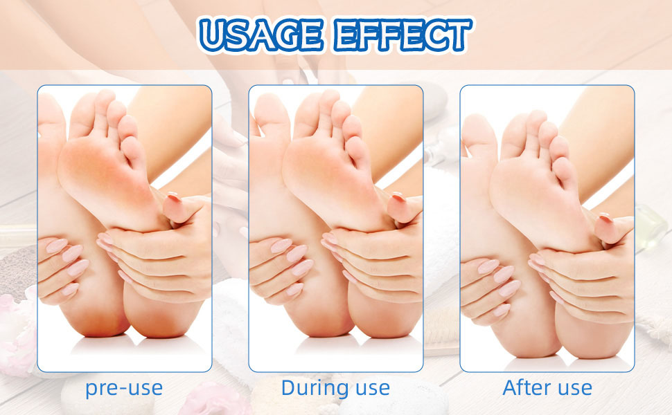 HOVGN electric foot file callus remover