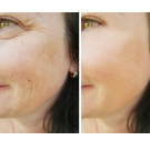 antioxidant properties protect skin from free radicals that could trigger fine lines, wrinkles.