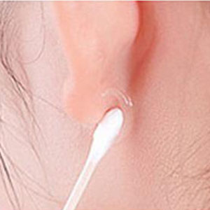 Hair dye allergy test