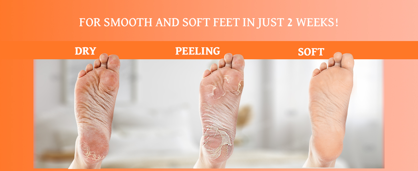 for smooth and soft feet in just 2 weeks!