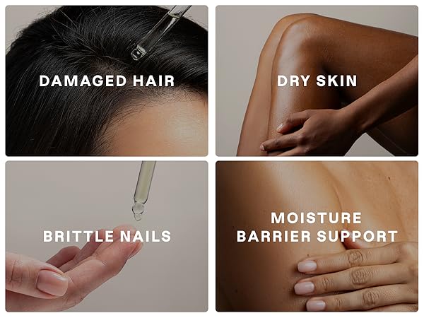 Damaged Hair, Dry Skin, Brittle Nails, Moisture