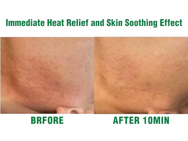 Amazon.com: CONAPIDIL Greenboxin - Rapid Skin Soothing, Heat