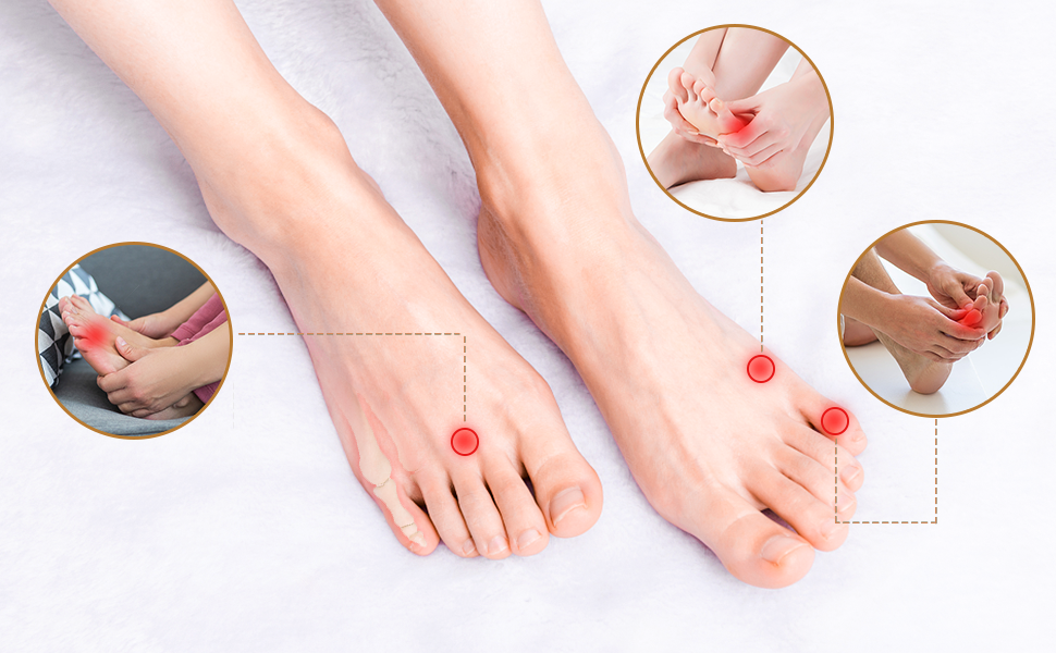 Bunion Relief Sleeve