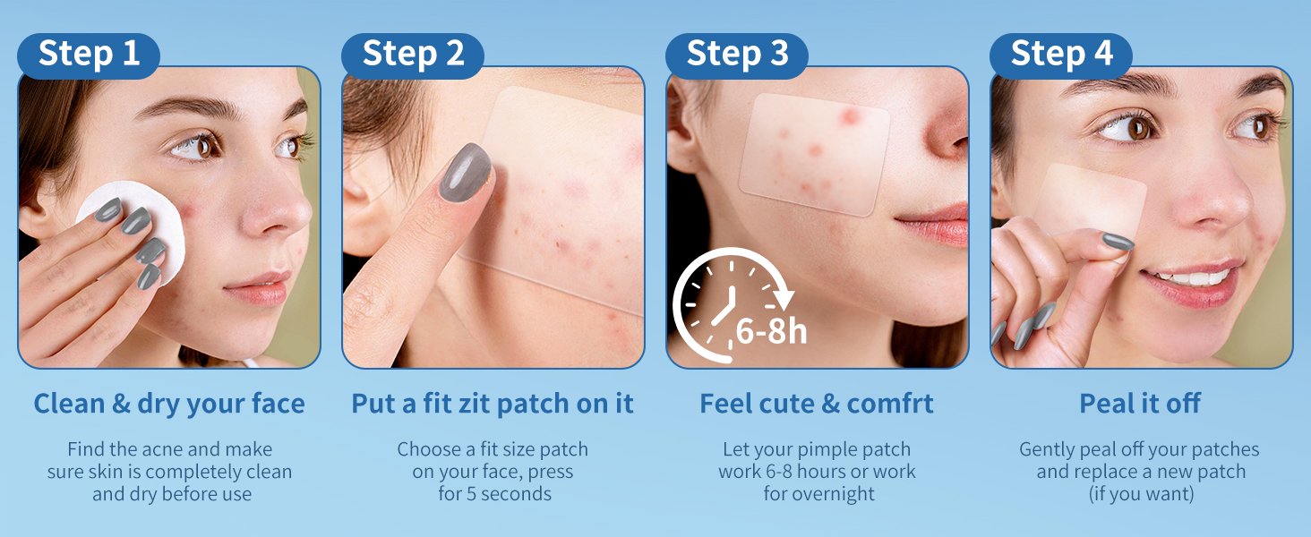 pimple patches