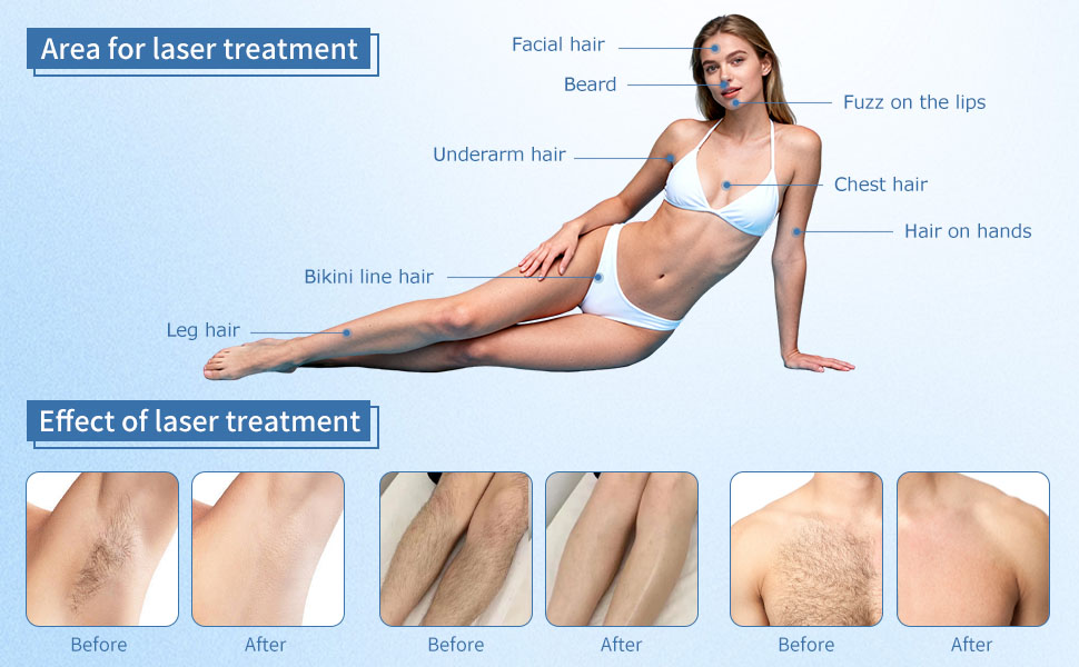 Text reads 'Area for facial treatment'. Medical diagram showing numbered treatment zones on body with multiple demonstration images.