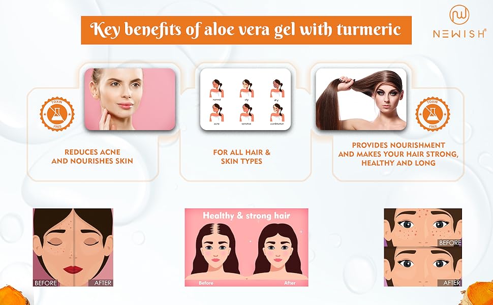 aloe vera gel for skin, aloe vera gel wow, aloe vera gel, body cupid aloe vera gel, wow aloe vera