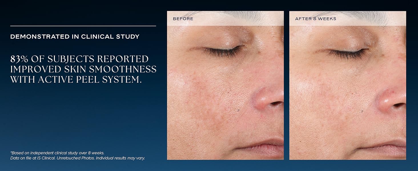 clinical study 83% subjects reported improved skin smoothness 