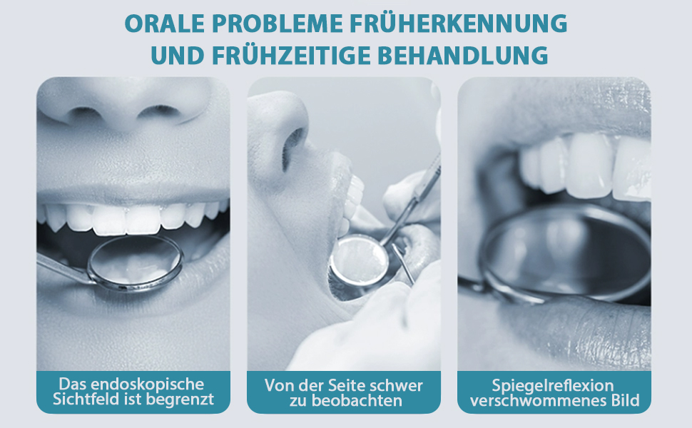 Intraoraler Fotospiegel