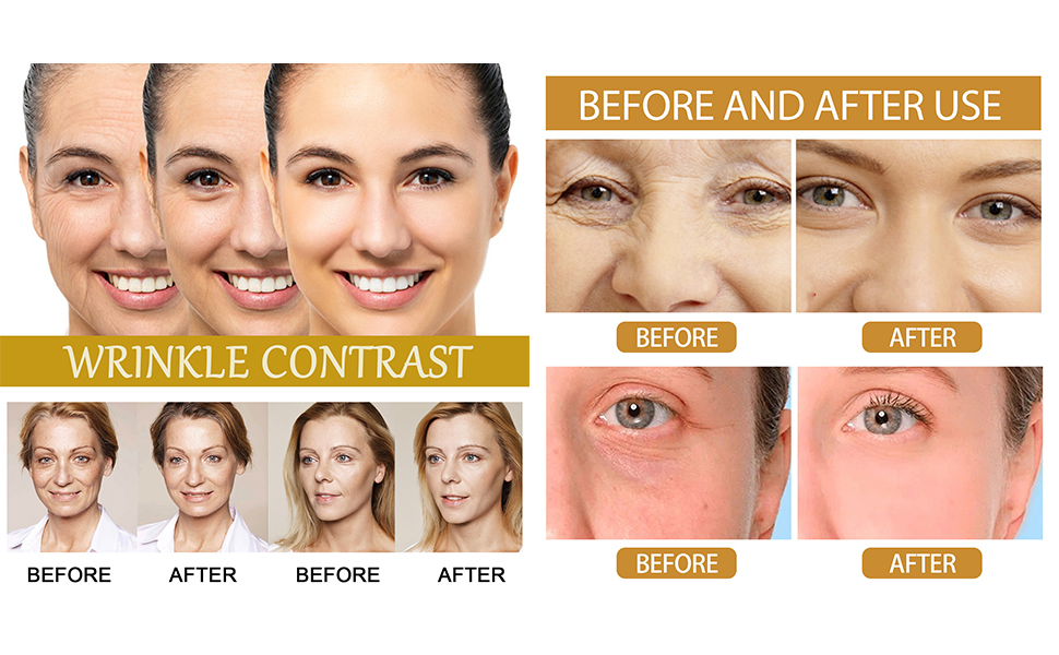 Anti-Wrinkle Firming Serum