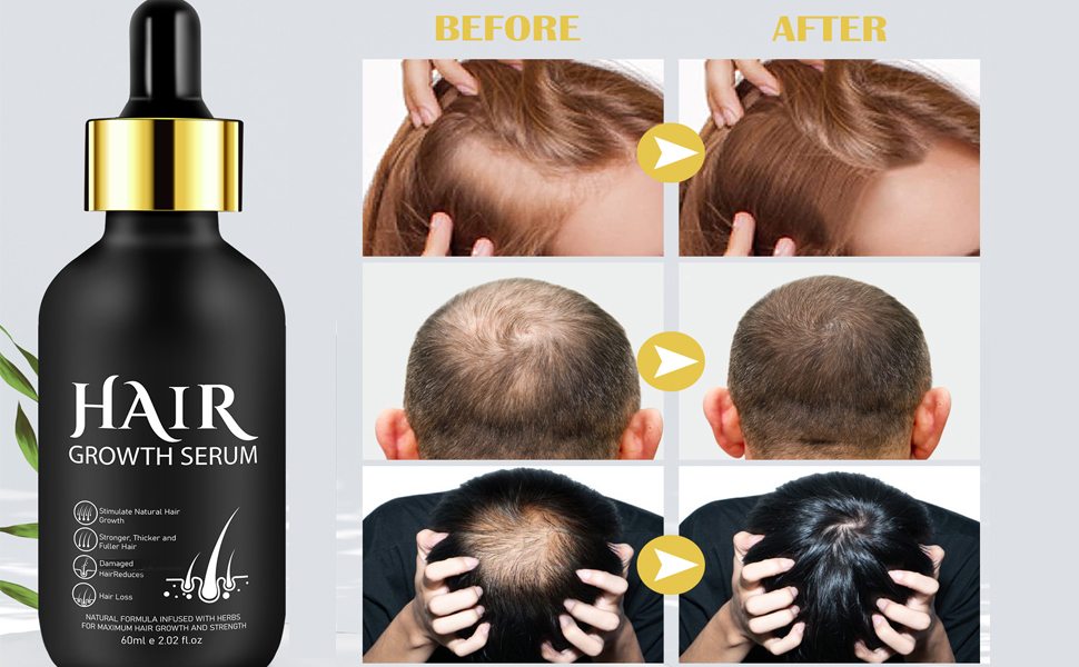 Organic Dr. Sebi Raw Batana Oil from Honduras, Natural Hair Growth Oil