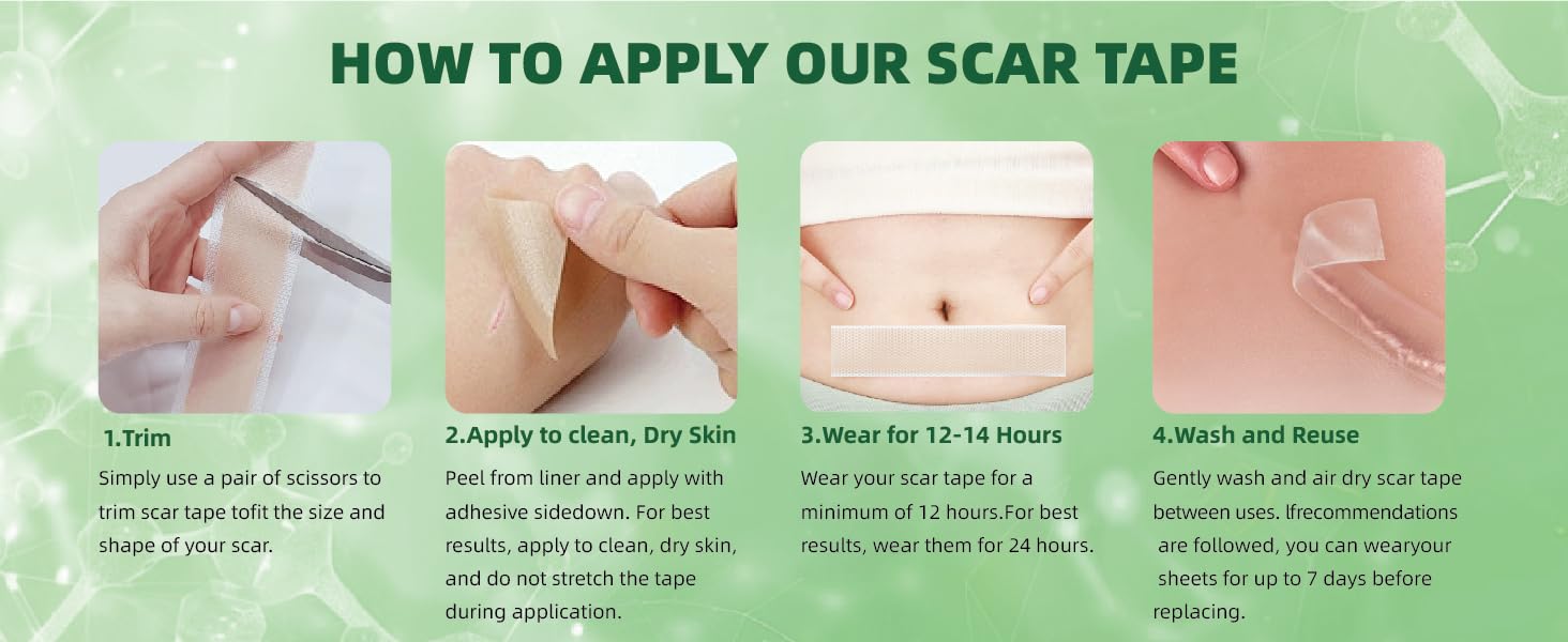 Silicone Scar Sheets