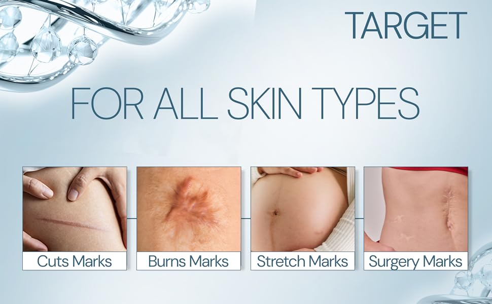 vitaderm_c_scar_gel_slide4