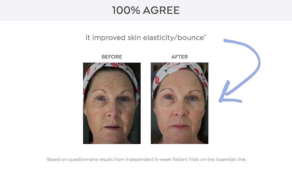 Peptide + Ceramide Repairing Moisturizer Before &amp; After