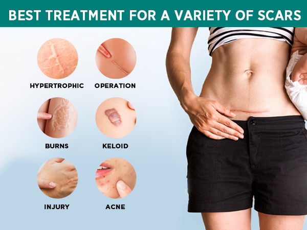 Sports Scars in Boys: How to Heal Them and Restore Smooth Skin