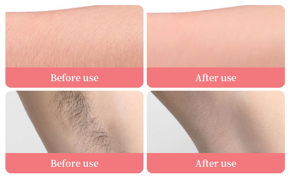 Crystal Hair Remover