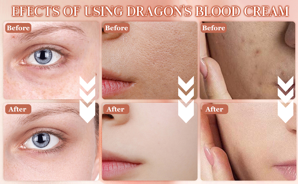 Paneles de comparación de antes y después que muestran los efectos de Dragon's Blood Cream en la textura y el aspecto de la piel, con indicadores de flechas blancas entre los paneles.