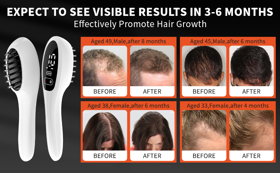 Laser Hair Regrowth Devices