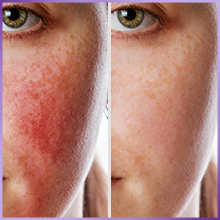 Aceite esencial de Lavanda Eclat