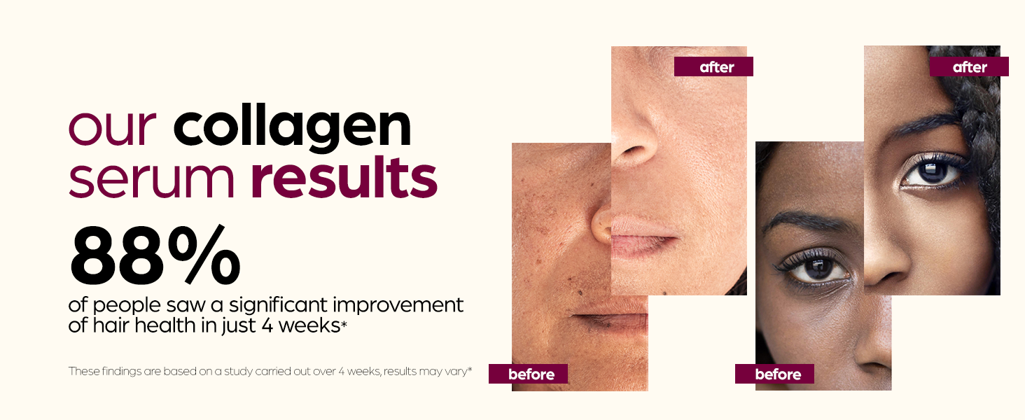 Collagen + Vitamin E Face Serum