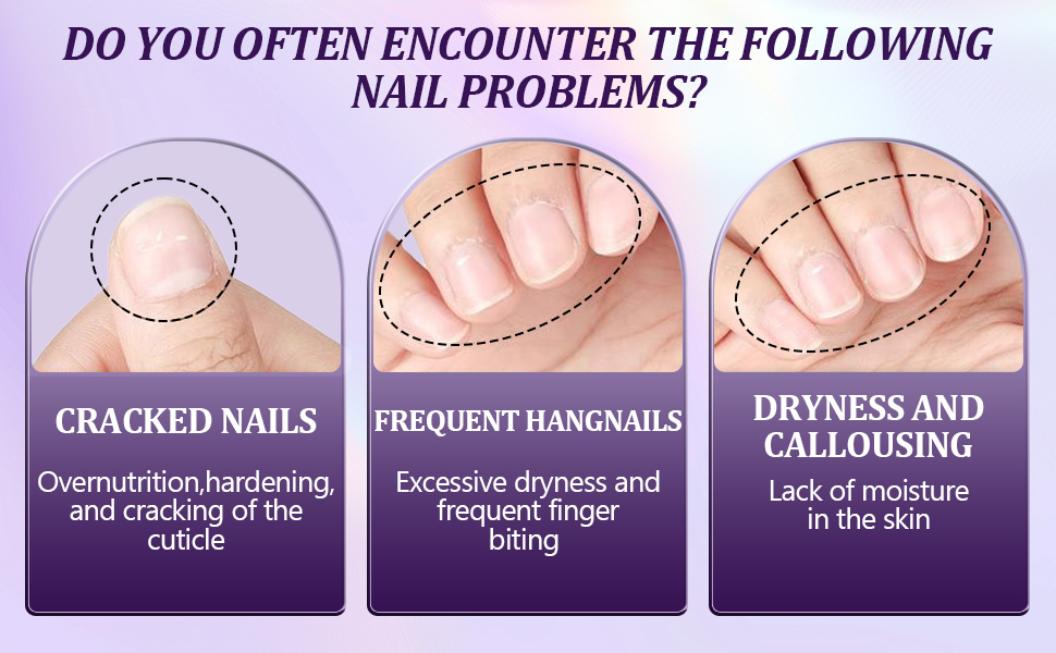 2025 upgraded cuticle oil pen for nails