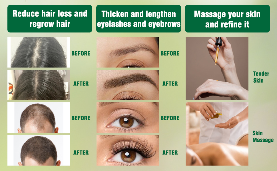 black castor oil