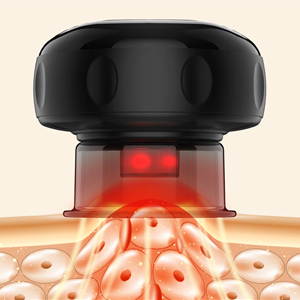 Smart Dynamic Cupping Device