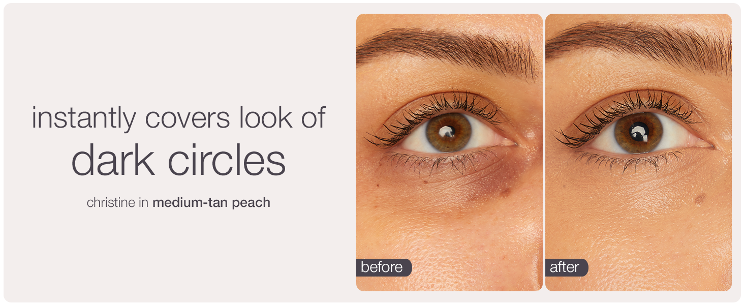 instantly covers dark circles