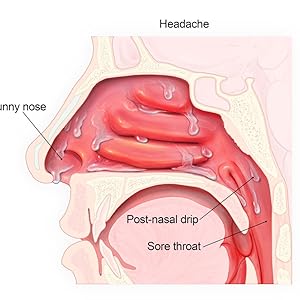 Buckley's Targeted Cough & Cold Relief