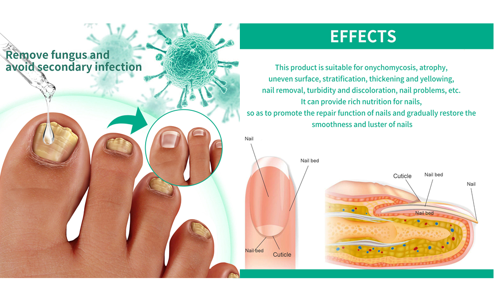 Kerāssentiāls Toenail Fungus Treatment