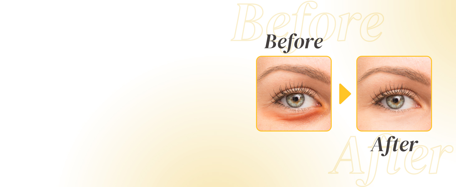 Enaskin Naturals Under Eye Gel Patches