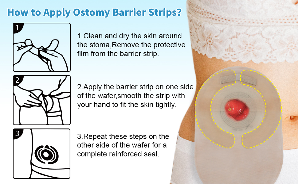 Ostomy Barrier Strips