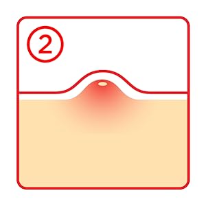 Tea Tree Clear – Dot Patch