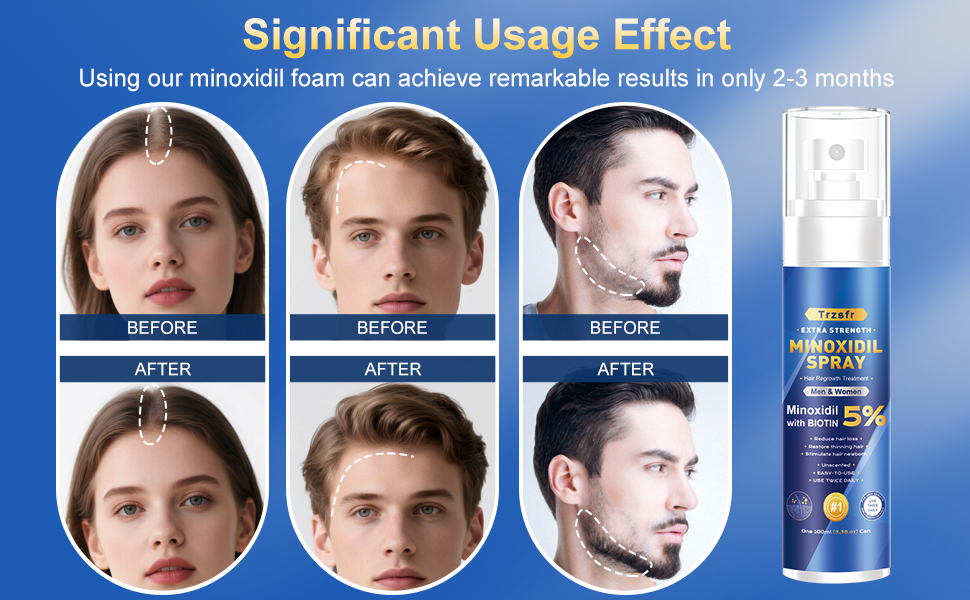 hair growth oil spray for women