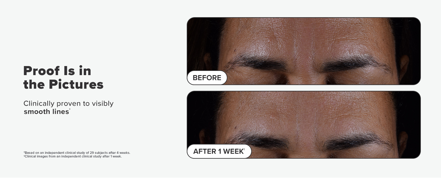 2% bha liquid exfoliant toner smooth lines