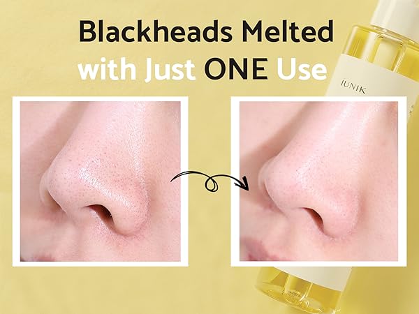 Pore Cleanser Effective After 1 Use Sebaceous Filaments Blackheads Whiteheads Clogged Pores Removal