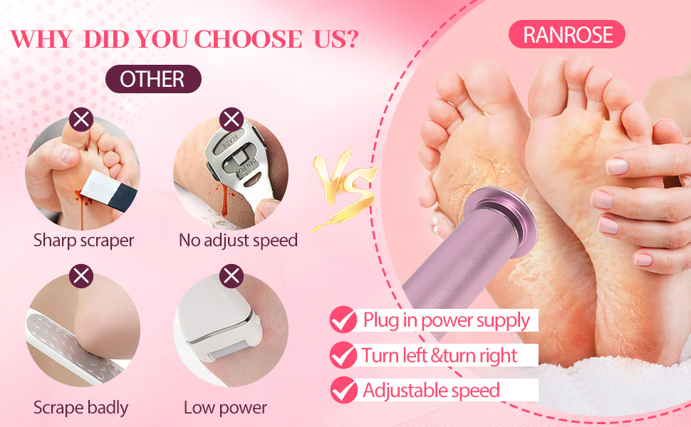 Electric callus remover for feet