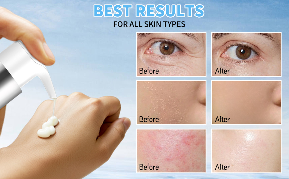 collagen hyaluronic acid serum; hyaluronic acid collagen moisturizer;