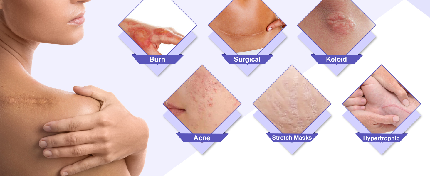scar removal