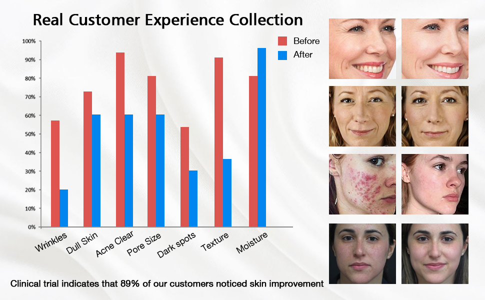 blue red light therapy for wrinkles acne
