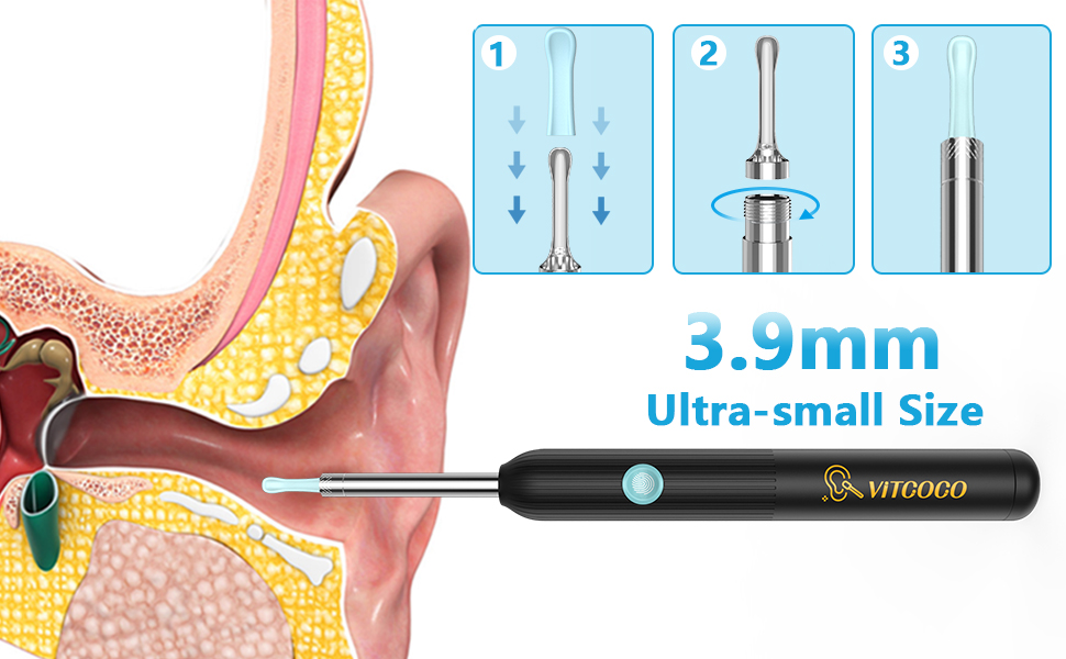 【NEW VERSION】VITCOCO Ear Wax Remover, Wireless Ear Cleaner with 1920P