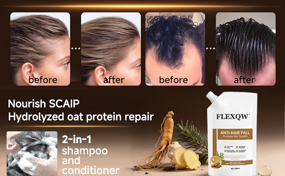 anti hair fall shampoo