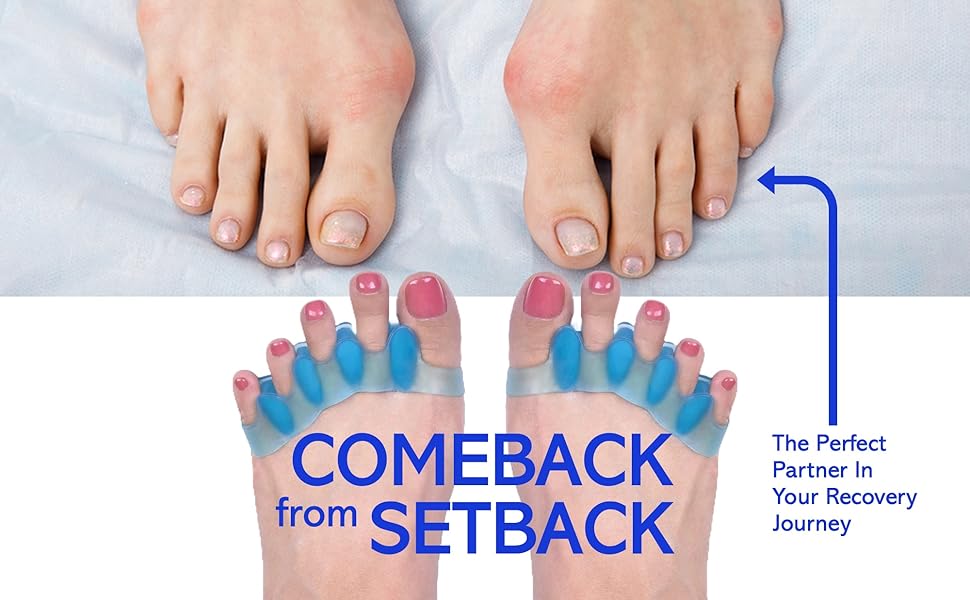 Toe Separator