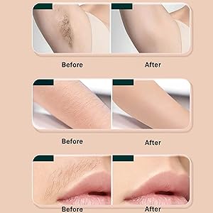 Epilators Hair Removal for Women