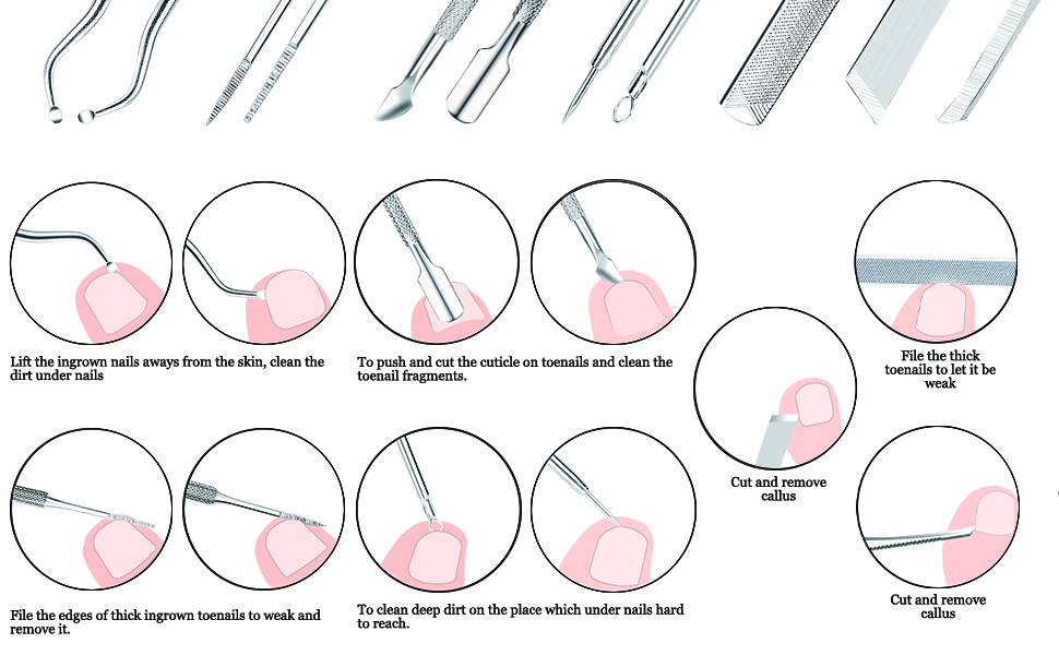 ZIZZON 7 Pcs Ingrown Toenail File and Lifters Set, Stainless Steel Ingrown Toenail Removal Kit